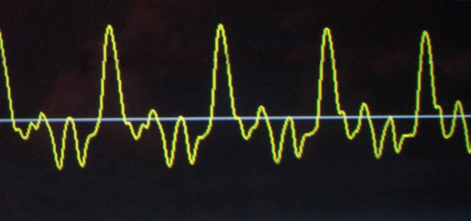 Wurlizer Electrostatic Organs By Eric Larson